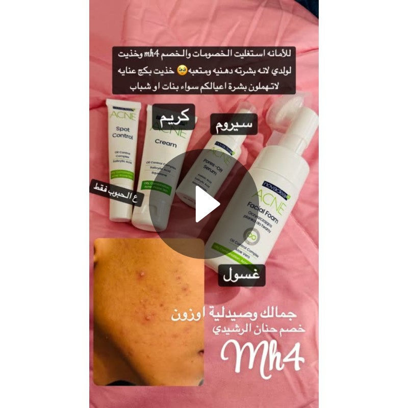 للأمانه استغليت الخصومات والخصم mh4 وخذيت لولدي لانه بشرته دهنيه ومتعبه ...